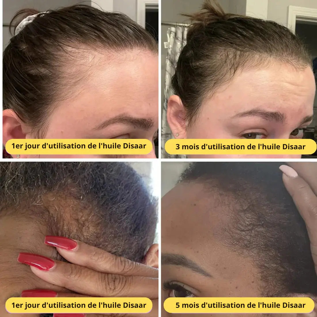 Huile Croissance & Nutrition Naturelle - Disaar